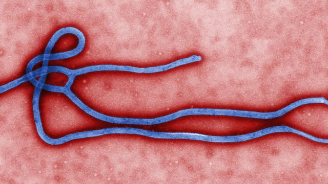 Virus ebole (foto: Wikipedia)