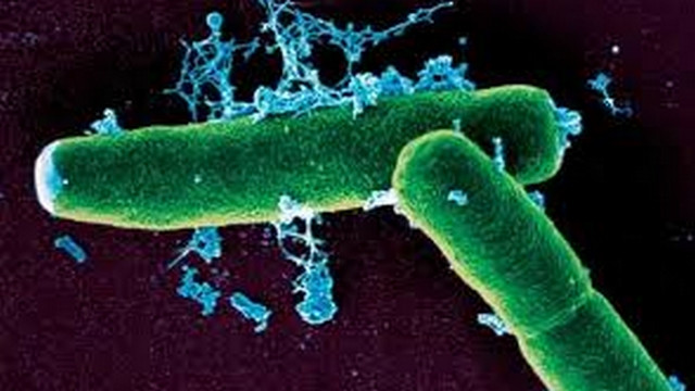 Anthrax bacillus (foto: Splet)