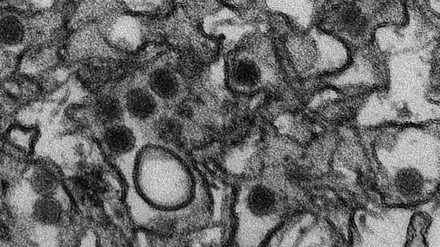 Virus zika (foto: Wikipedia)