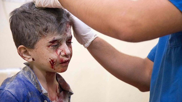Ranjeni otrok v Alepu (foto: Radio Vatikan)