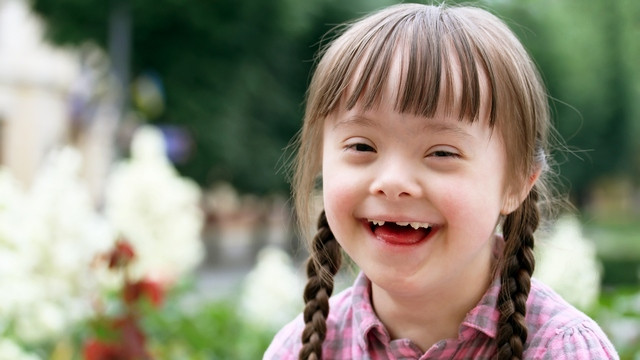 deklica z Downovim sindromom (foto: splet)