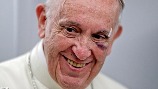 Papež nasmejan kljub podplutbi na liičnici (foto: Radio Vatikan)