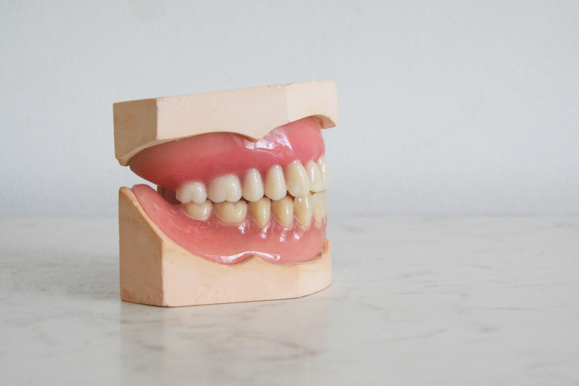 Bruksizem (škrtanje) se prepozna po obrabljenih, skrajšanih zobeh