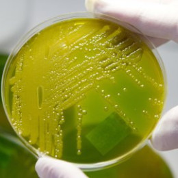 Vzorec bakterije Ehec (photo: EPA)