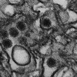 Virus zika (photo: Wikipedia)