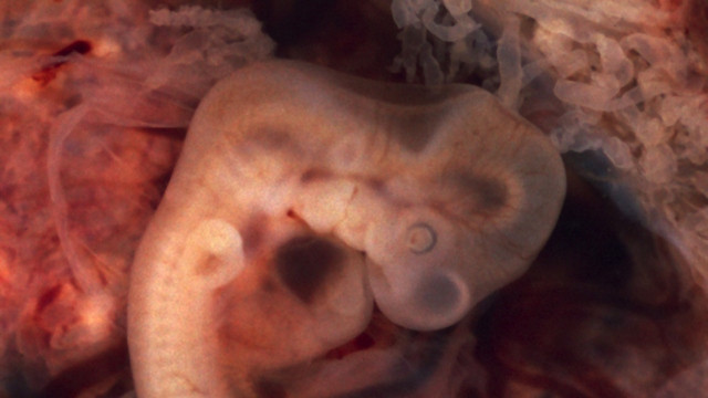 Po petih tednih nosečnosti je človeški plod velik že 10 milimetrov (foto: Wikipedia)