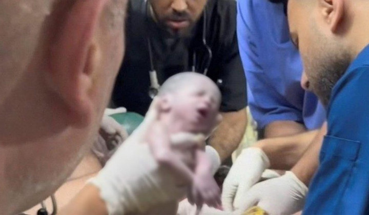 Novorojenka, rešena s carskim rezom iz mrtve matere (foto: Vatican news)