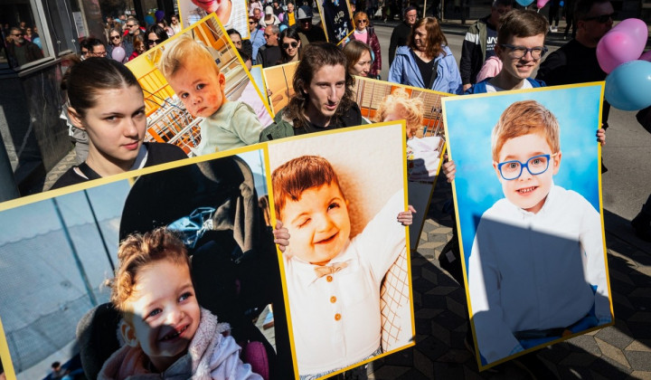 Fotografije otrok z redkimi boleznimi  (foto: Boštjan Podlogar/STA)